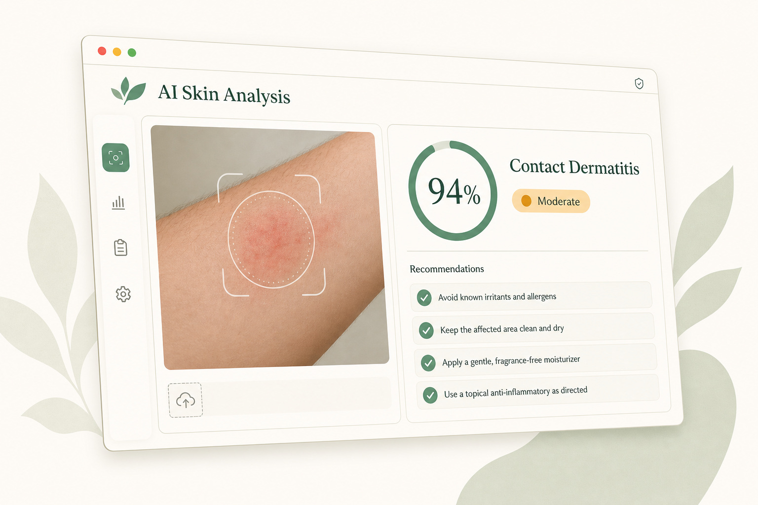 RashScan AI skin analysis results screen showing condition, confidence and recommendations