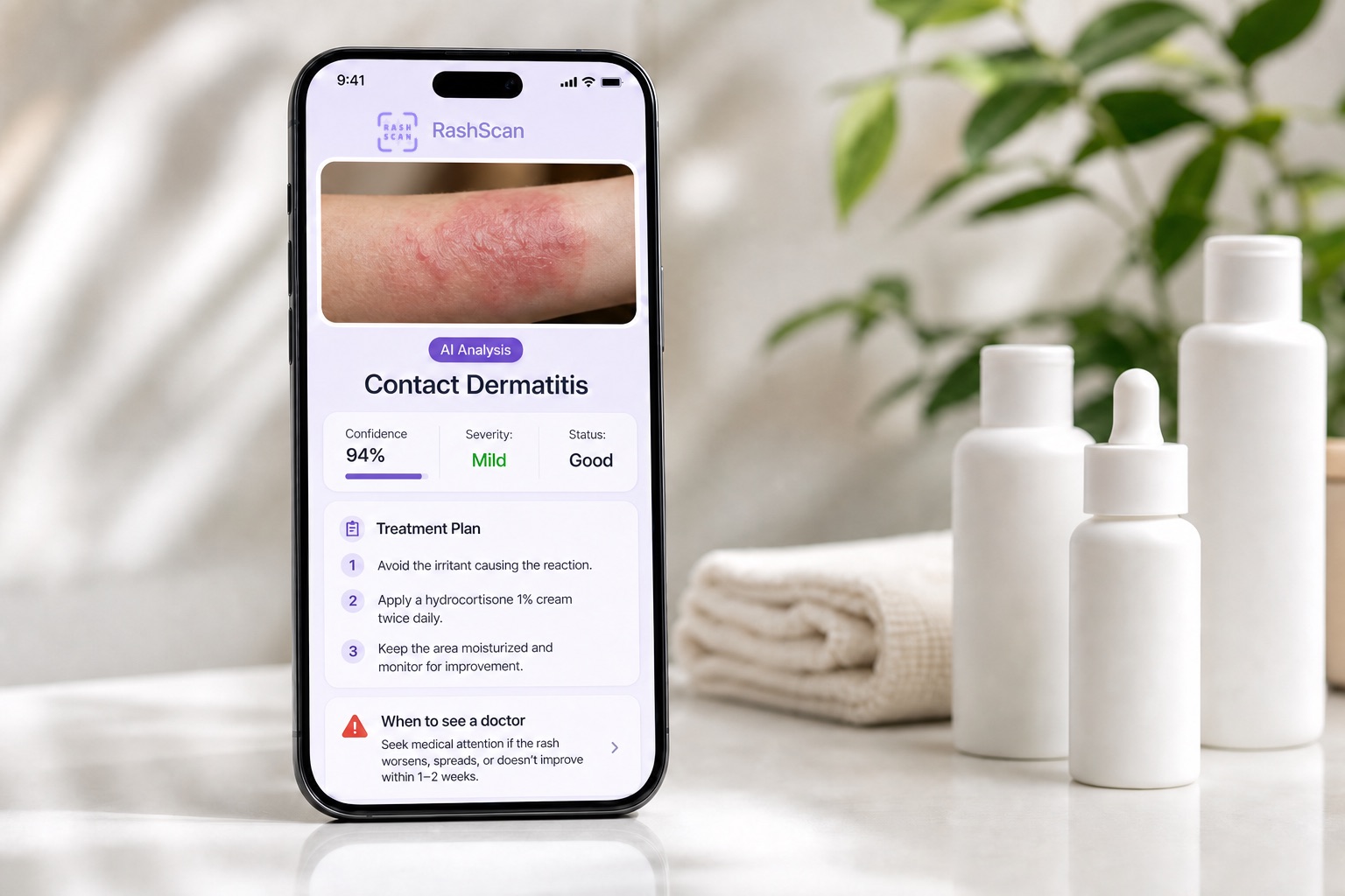 RashScan rash identifier results on a phone: contact dermatitis at 94% confidence with mild severity, treatment plan and when to see a doctor