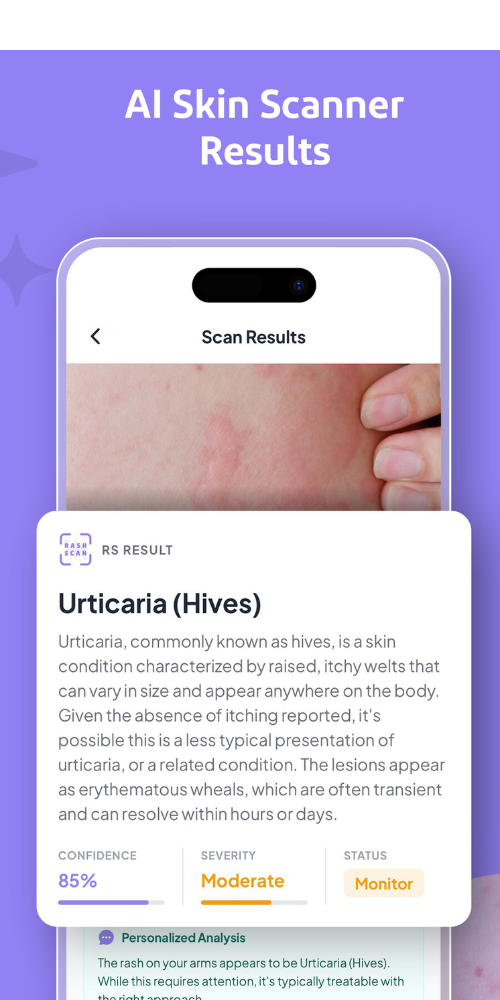 Rash Scan Camera Interface