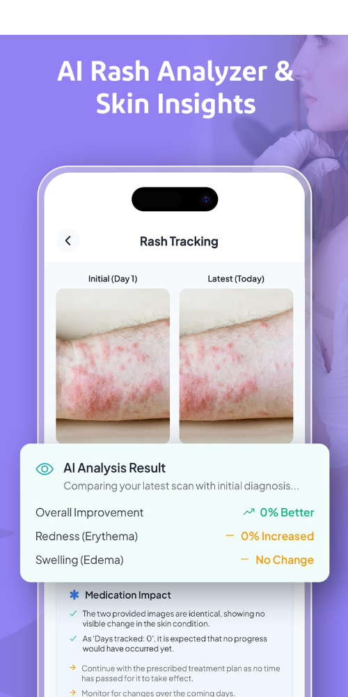 Rash Scan Analysis Results