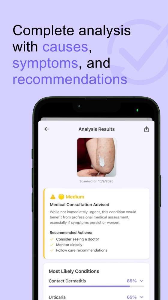 Rash Scan Analysis Results
