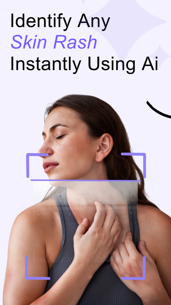 Rash Scan Camera Interface